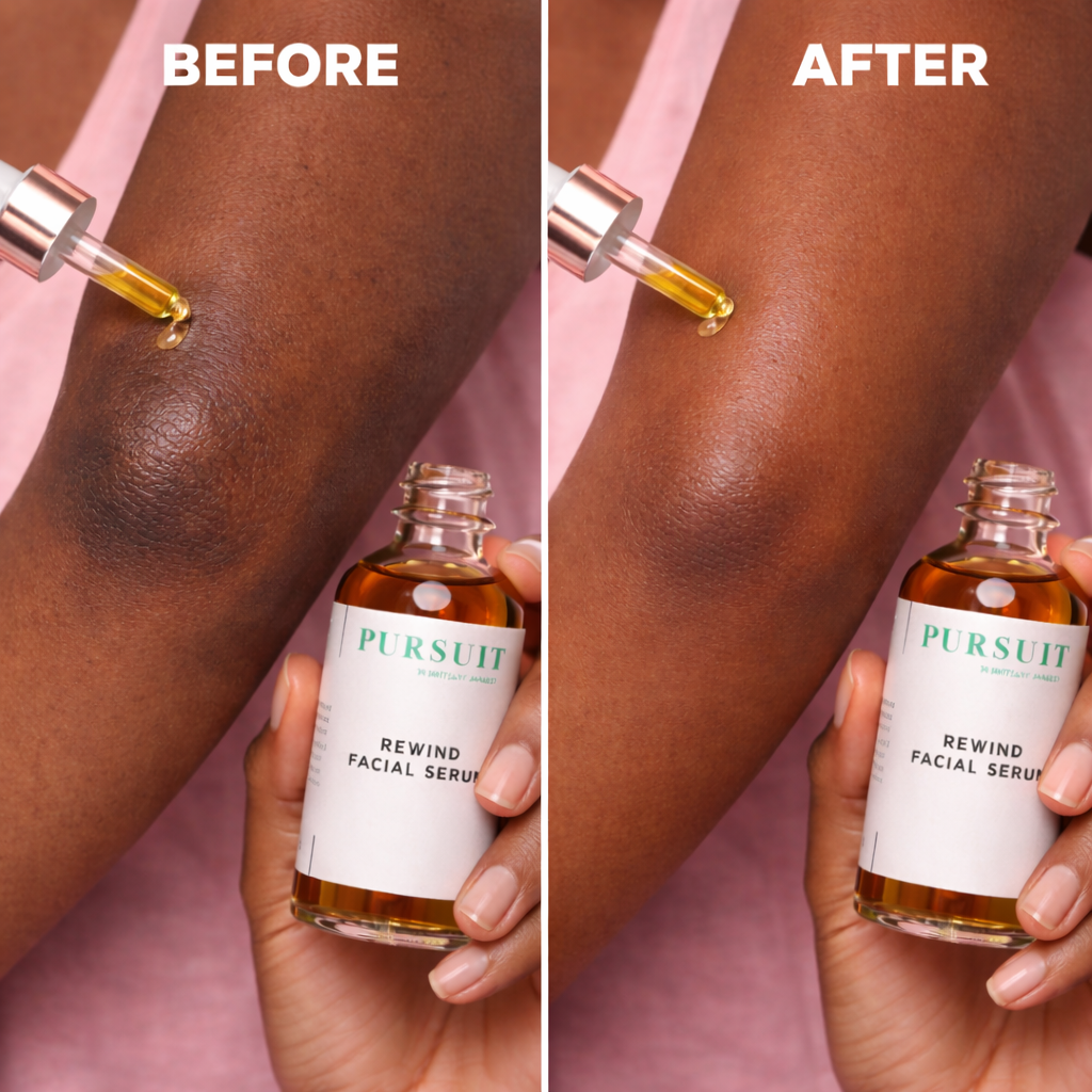 Rewind Facial Serum – Natural Skin Renewal