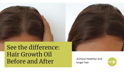 “Stimulate Me” Hair and Scalp treatment